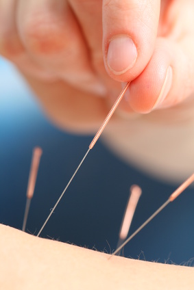 Akupunktur fördert Selbstheilung